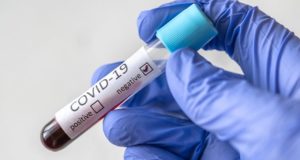 За сутки на Алтае выявлено 46 случаев заражения коронавирусом