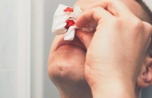 Драка между пьяными сельчанами из-за женщины вылилась в уголовное дело