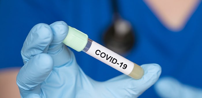 19 случаев заражения коронавирусом выявлено на Алтае за сутки
