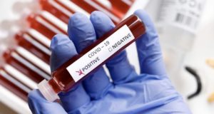16 случаев заражения коронавирусом выявили за минувшие сутки 16 случаев заражения коронавирусом выявили за минувшие сутки
