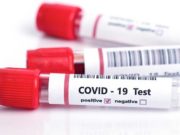 20 случаев заражения «ковидом» выявлено за сутки на Алтае