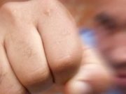 Дружеская потасовка на животноводческой стоянке закончилась разрывом селезенки Дружеская потасовка на животноводческой стоянке закончилась разрывом селезенки