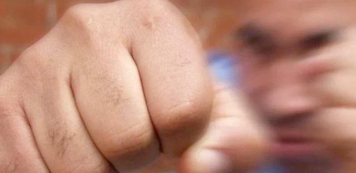 Дружеская потасовка на животноводческой стоянке закончилась разрывом селезенки