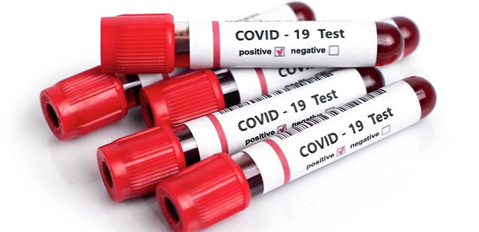 Сводка за неделю по ситуации с коронавирусом: 51 заболевший, 8 умерших