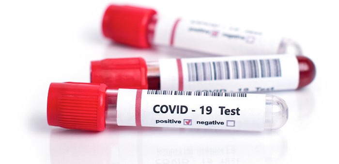 139 человек заболели коронавирусом за неделю, более половины из них – в Кош-Агачском районе