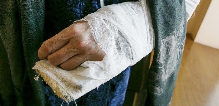 Пенсионерке выплатят компенсацию 100 тысяч за сломанную руку