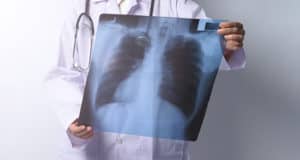 75 больных туберкулезом выявили в Республике Алтай в прошлом году
