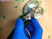 Ситуация с корью в Республике Алтай Очаг кори в Республике Алтай локализован