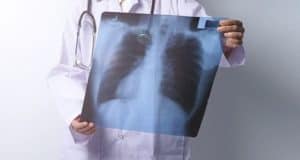 С начала года на Алтае туберкулез выявили у десятков человек