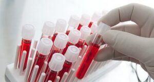 В Горно-Алтайске провели бесплатное тестирование на ВИЧ-инфекцию В Горно-Алтайске провели бесплатное тестирование на ВИЧ-инфекцию