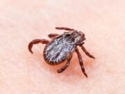 На Алтае растет число пострадавших от укусов клещей