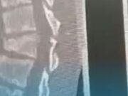 Нейрохирурги поставили на ноги парализованную после травмы девочку Девочка-подросток получила серьезную травму, упав с четвертого этажа