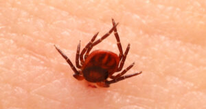 Клещевой сезон набирает обороты: пострадали уже шесть человек