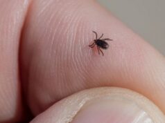 За неделю от укусов клещей пострадали два человека