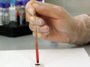 Освидетельствовать иностранных граждан смогут только государственные медучреждения Освидетельствовать иностранных граждан смогут только государственные медучреждения