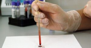 Освидетельствовать иностранных граждан смогут только государственные медучреждения