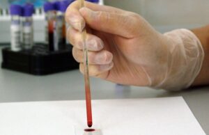 Освидетельствовать иностранных граждан смогут только государственные медучреждения